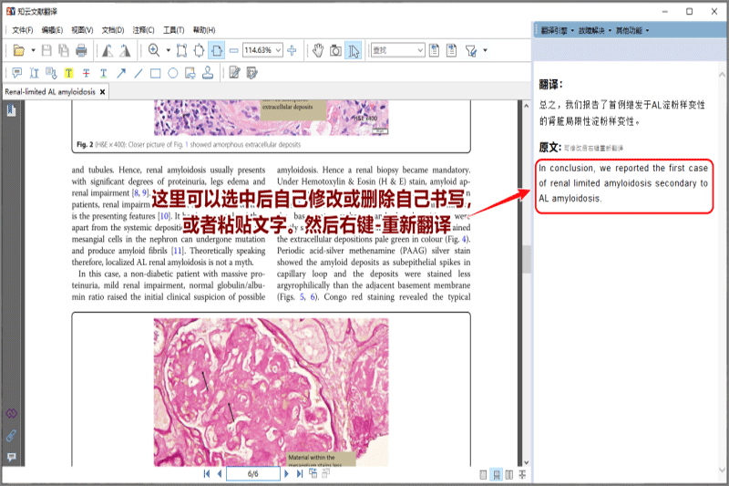 知云文獻翻譯